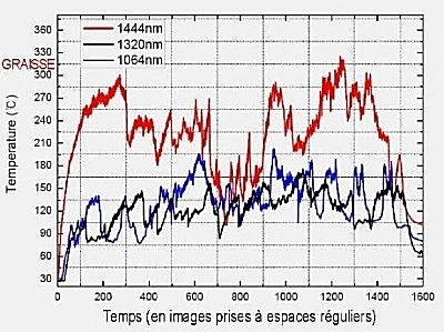 La puissance du 1444nm. - Médecine Esthétique Paris 